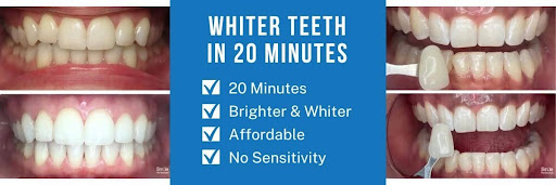 whiterteeth